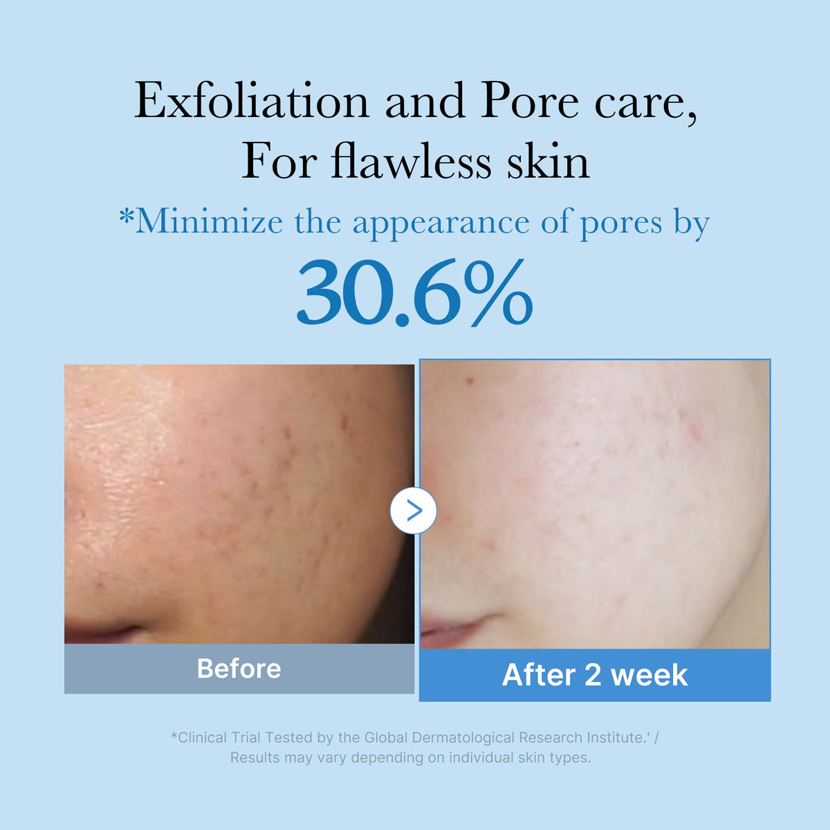 zero-pore-toner-b5 01_d6480b4e-3c08-4954-994a-ed5212c1839c.jpg