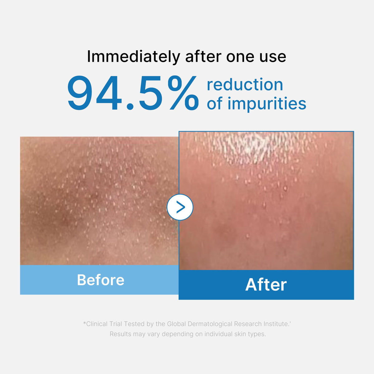 zero-pore-blackhead-deep-cleansing-oil-j8 01_eed557ec-5857-46a2-8b17-dbd67c692dcb.jpg