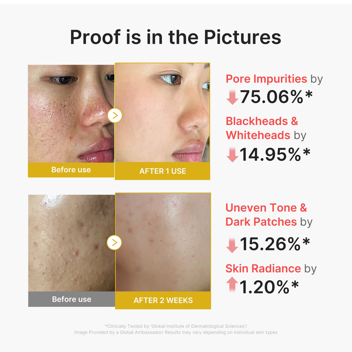 kojic-acid-turmeric-peel-shot-j4 02_45fe66d3-b3f6-4100-aa52-2afd7eded417.jpg
