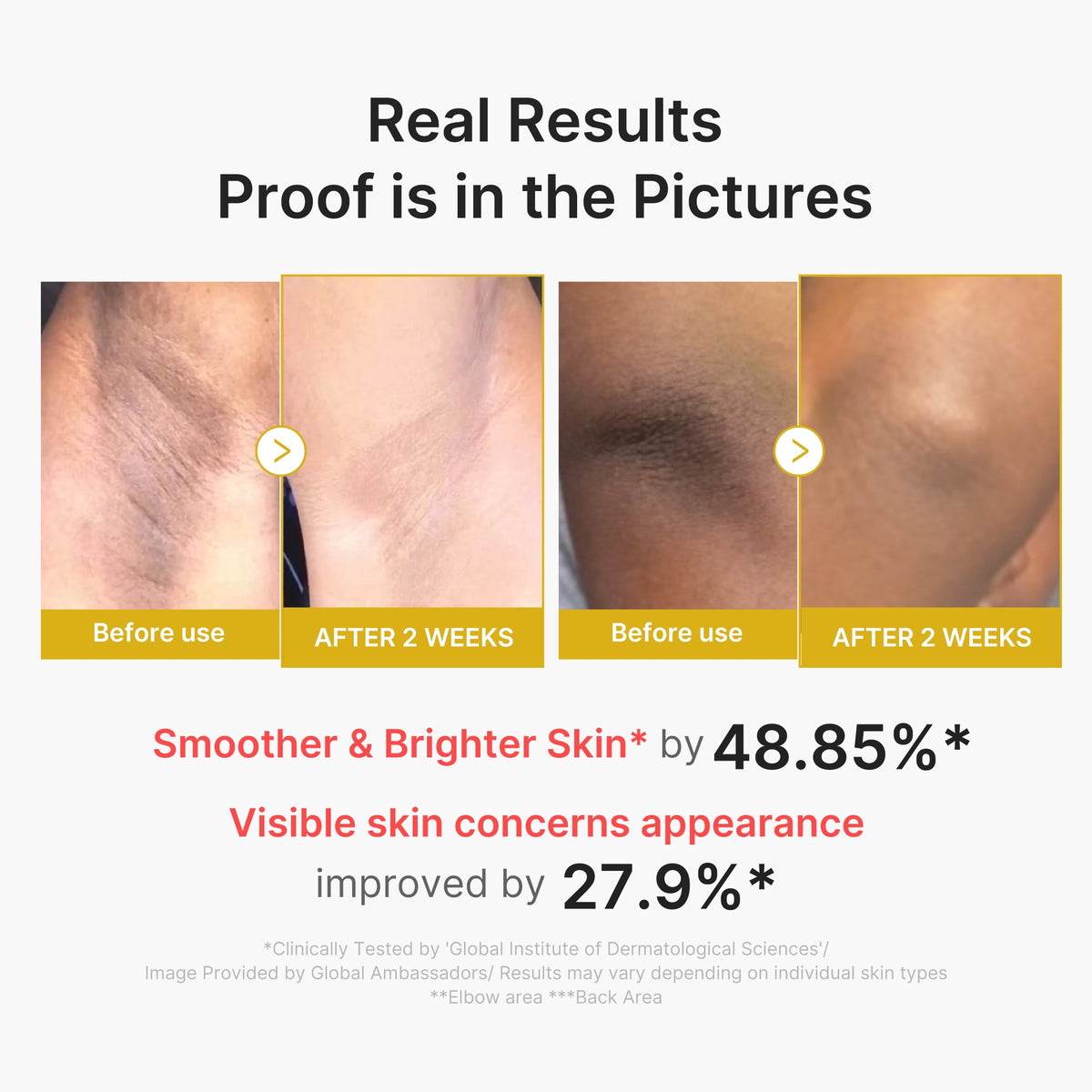 kojic-acid-turmeric-body-peel-shot-o3 02_72880cfc-382b-440b-8152-7e3dce87da2a.jpg