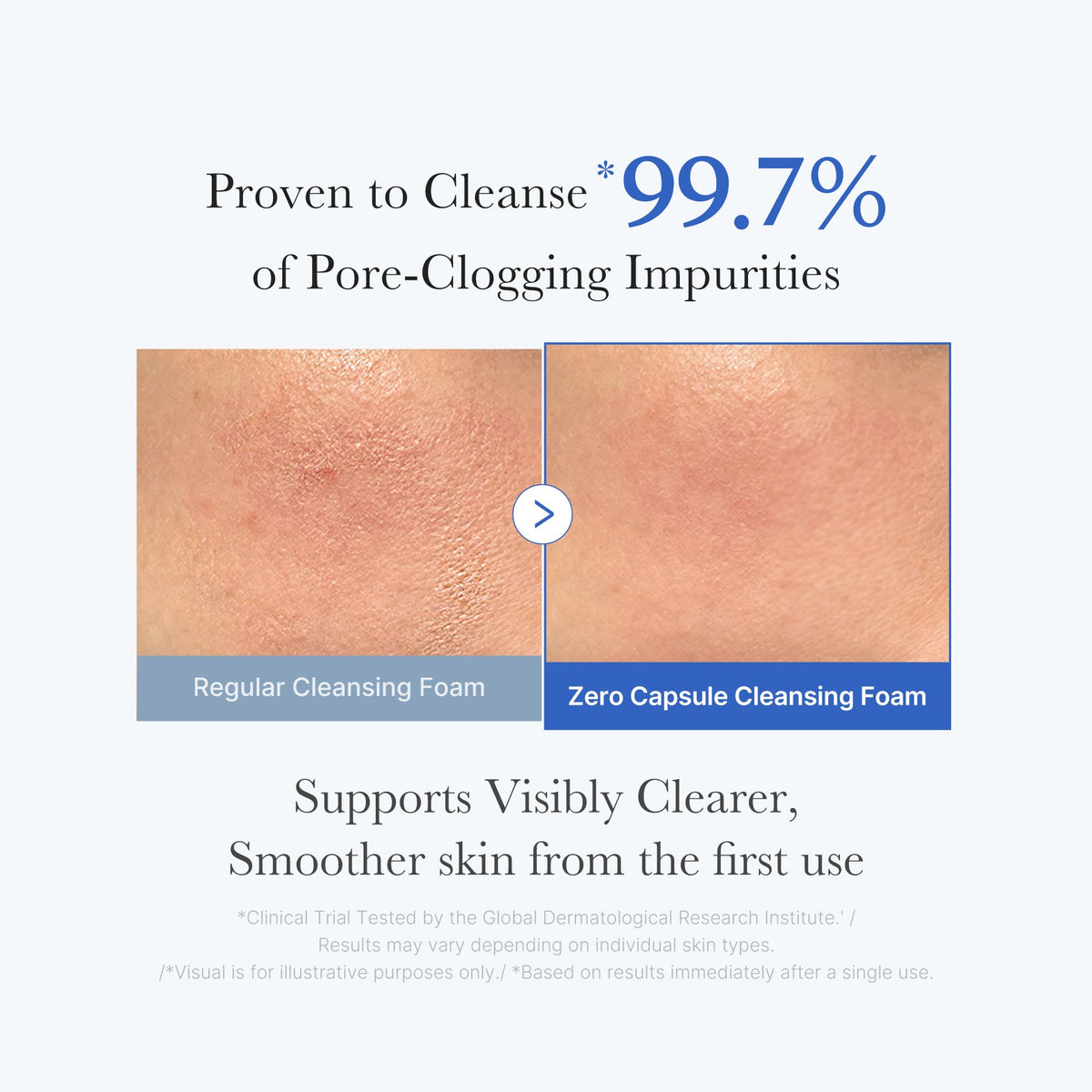 zero-pore-capsule-cleansing-foam-d8 02_c1fb9dfb-86c5-4038-8ff8-490d1006276c.jpg