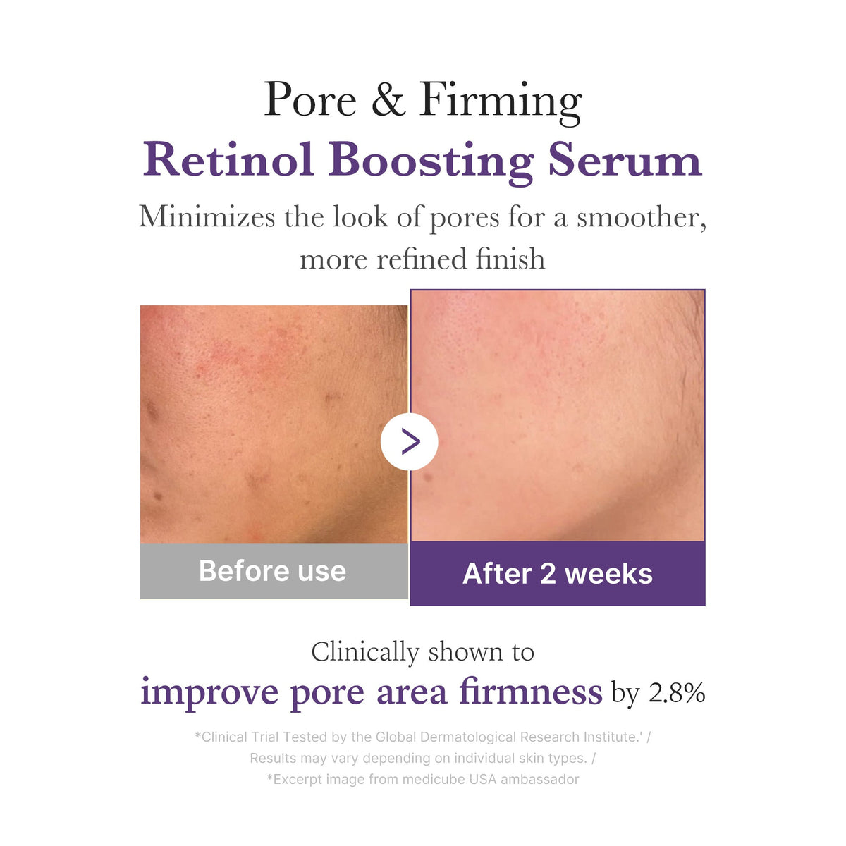 retinol-nmn-boosting-serum-s4 03_3510e7a5-5633-4a18-81ea-1389593bd517.jpg