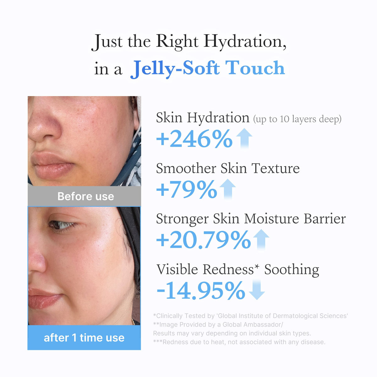 hyaluronic-ceramide-moisturizing-jelly-cream-g7 03_c39d66cc-0839-4e48-ab4a-d32143d06b1c.jpg