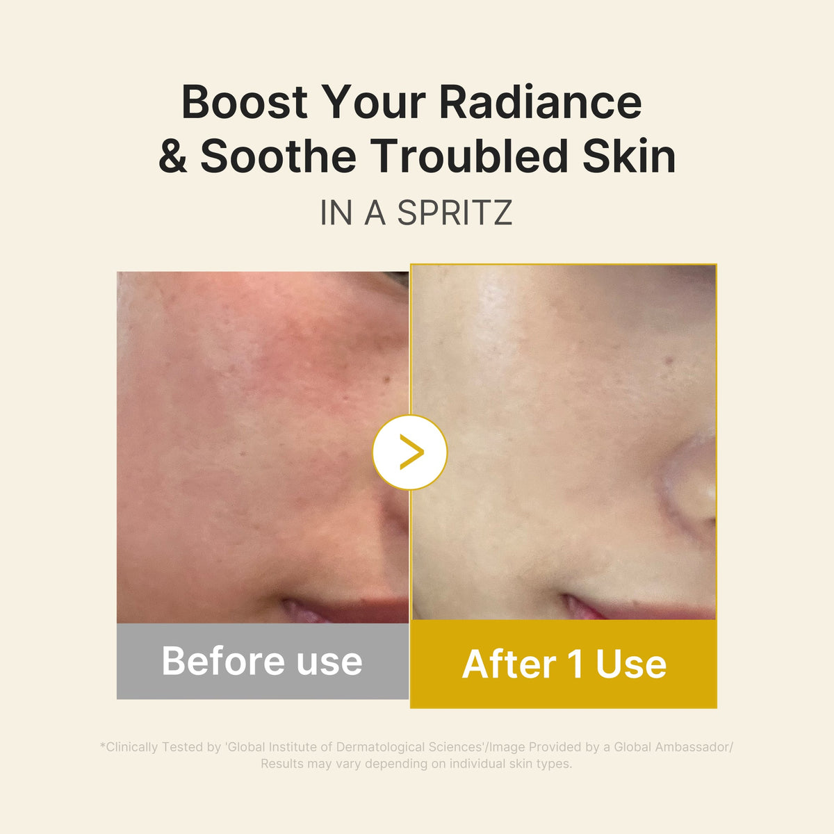 kojic-acid-turmeric-vitamin-gold-jelly-mist-serum-u6 03_dc9cd19e-4e57-49d3-9b66-c7762e8a63f1.jpg