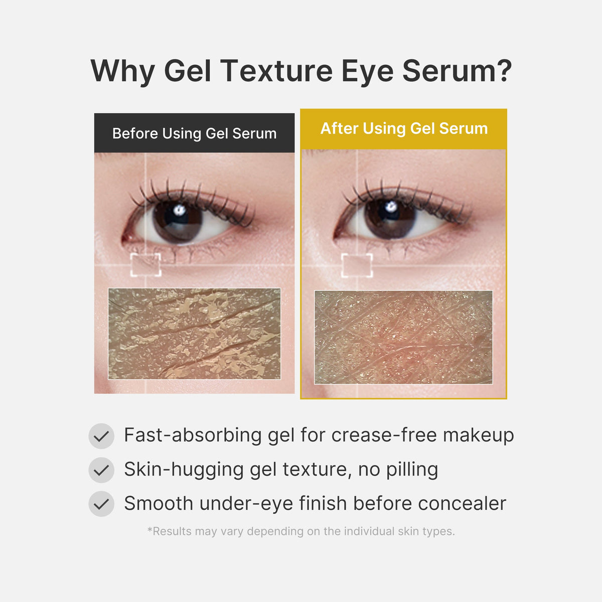 kojic-acid-tumeric-eye-gel-serum-h8 04_0487ef36-49f4-4294-8049-bb55118b05fe.jpg