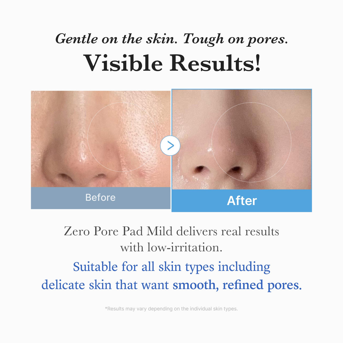 zero-pore-madecassoside-pads-mild-h1 04_6357f9f9-483b-4891-82c6-a58d336e62c8.jpg