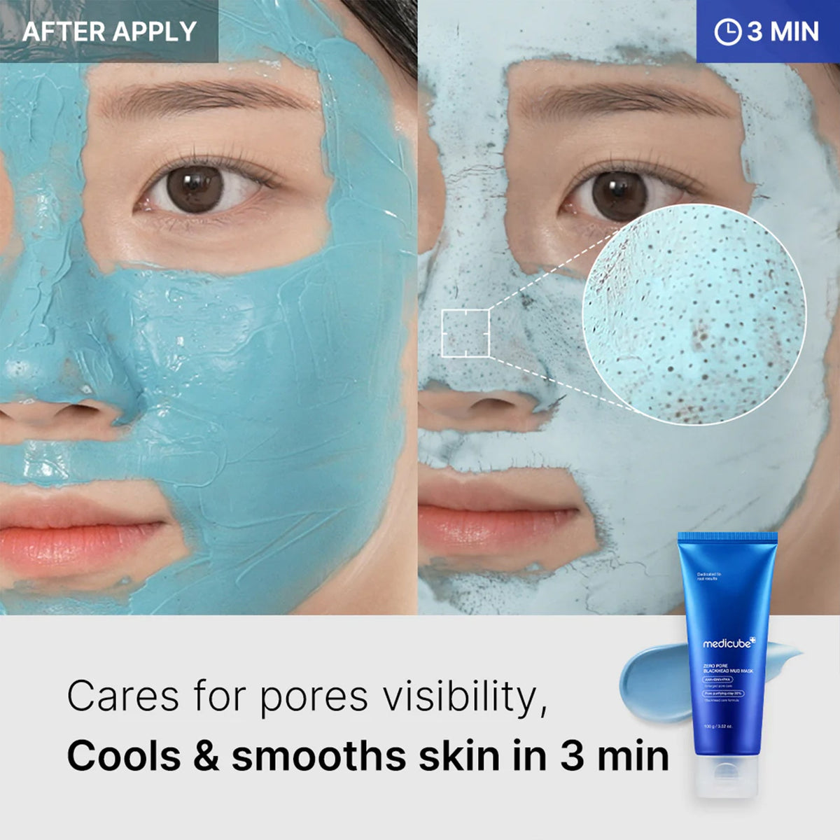 zero-pore-blackhead-mud-mask-w6 04_867c0459-a94e-40d3-bd9a-70400edabe8d.jpg
