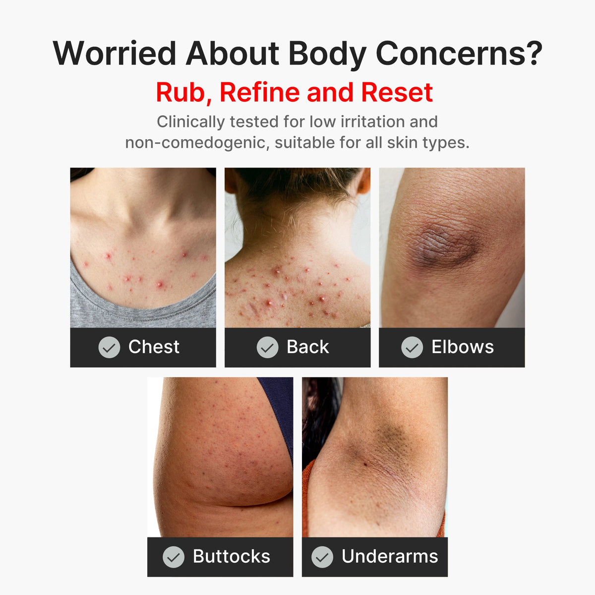 kojic-acid-turmeric-body-peel-shot-o3 04_8a7237f2-3ebf-401e-bd85-54841aeb3efc.jpg