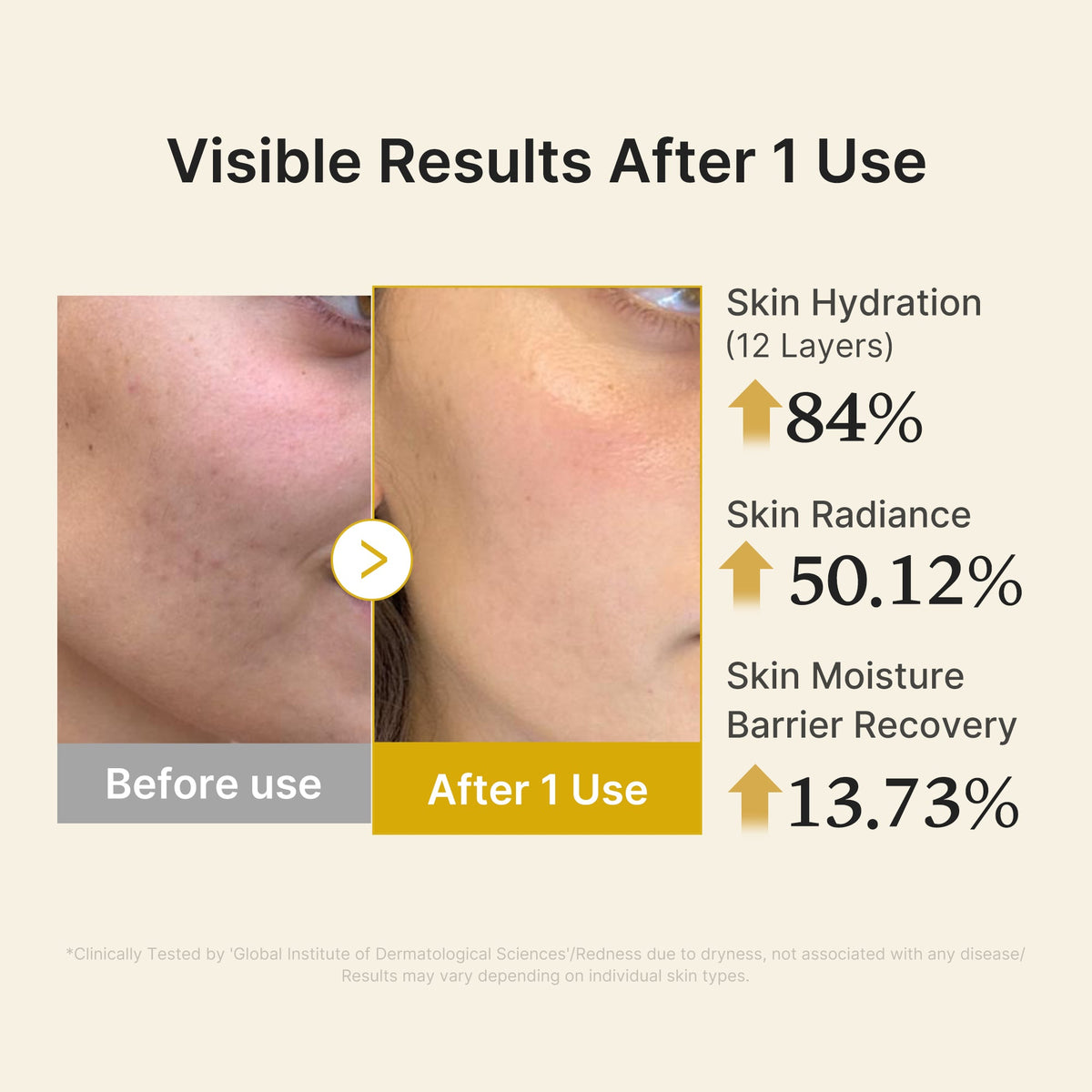 kojic-acid-turmeric-vitamin-gold-jelly-mist-serum-u6 04_d5c55ef1-e03b-494d-bc0d-a1ecc7fc2abf.jpg