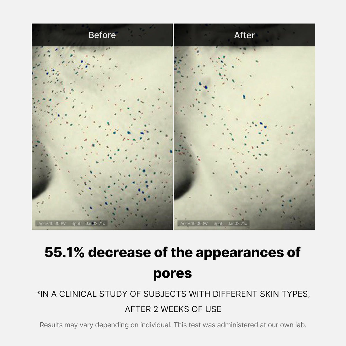 pore-care-duo-z6 05_12ddab8a-64be-4612-8ee1-27e5ec701921.jpg