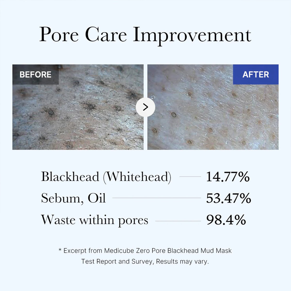 zero-pore-blackhead-mud-mask-w6 05_9362a158-c2b3-4525-acc0-631a2cfdea47.jpg