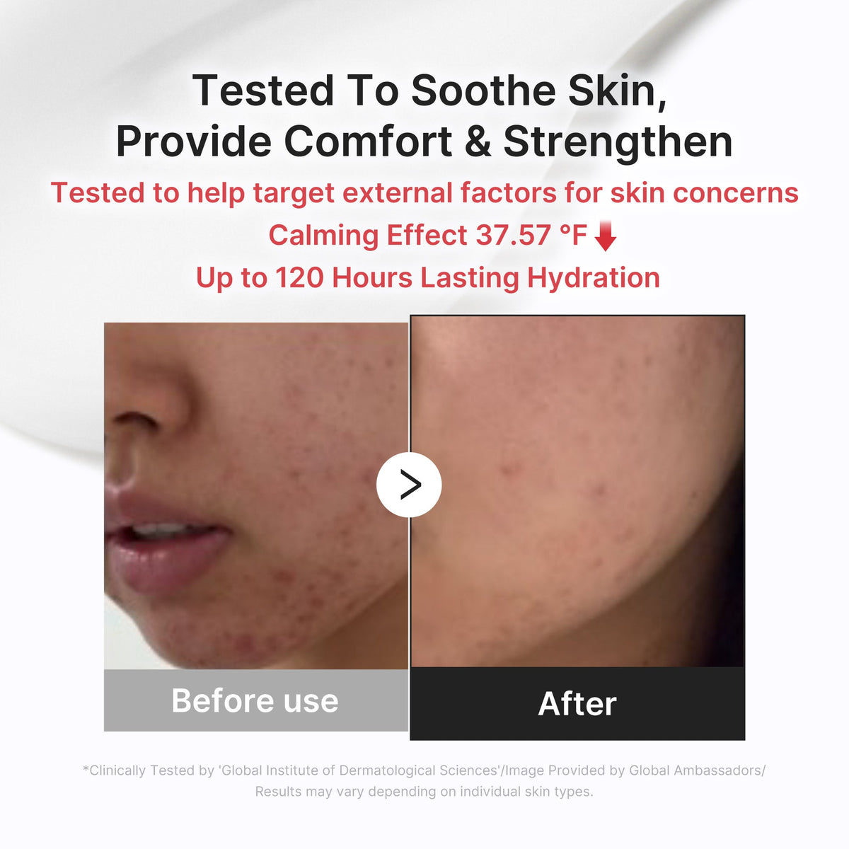 3h-daily-relief-cream-e5 3H_03.jpg