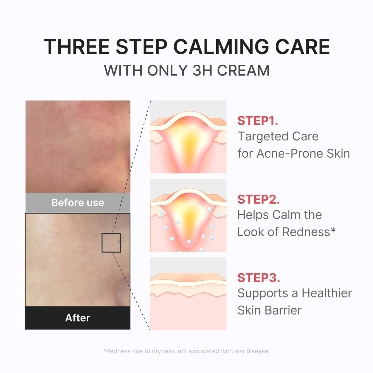 3h-daily-relief-cream-e5 3H_04.jpg