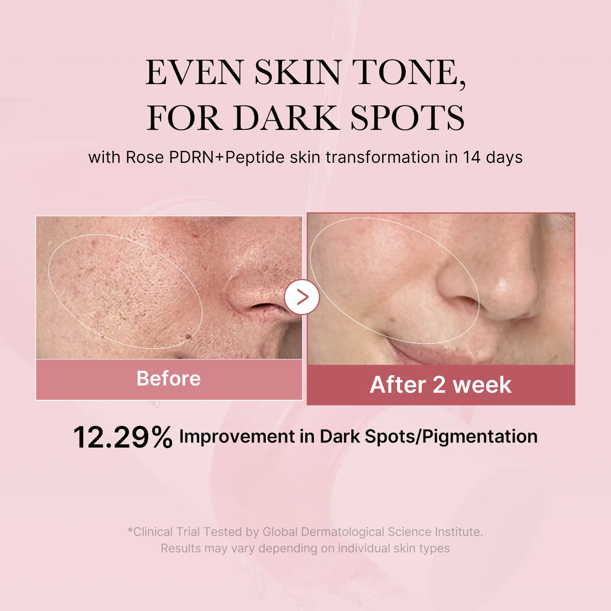 pdrn-pink-peptide-toner-q7 PDRN_01_308c518e-5ac6-4e54-99bd-eabc8796739b.jpg