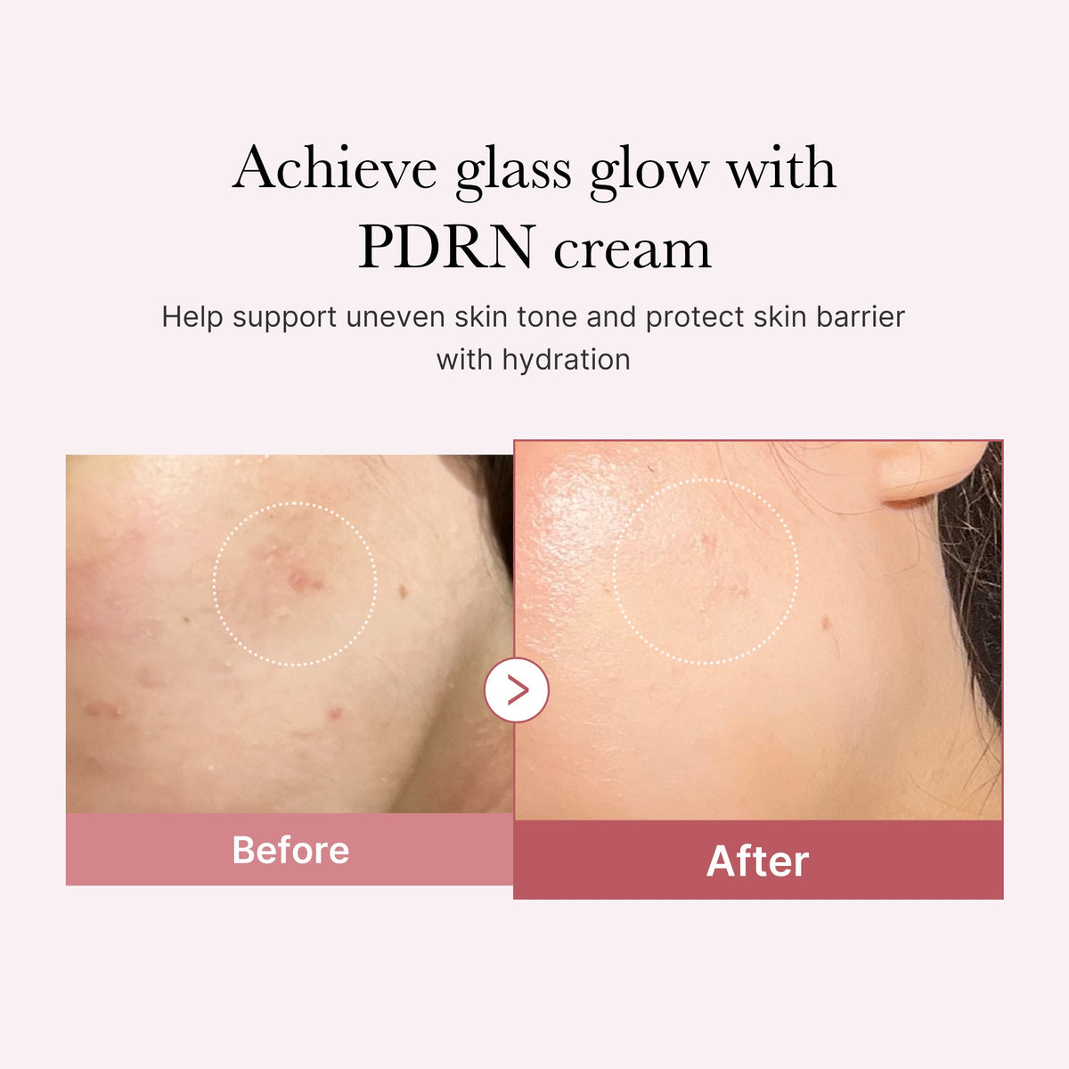 pdrn-pink-peptide-cream-n3 PDRN_02_d7805bfe-cf43-446a-b71b-a276683f136b.jpg