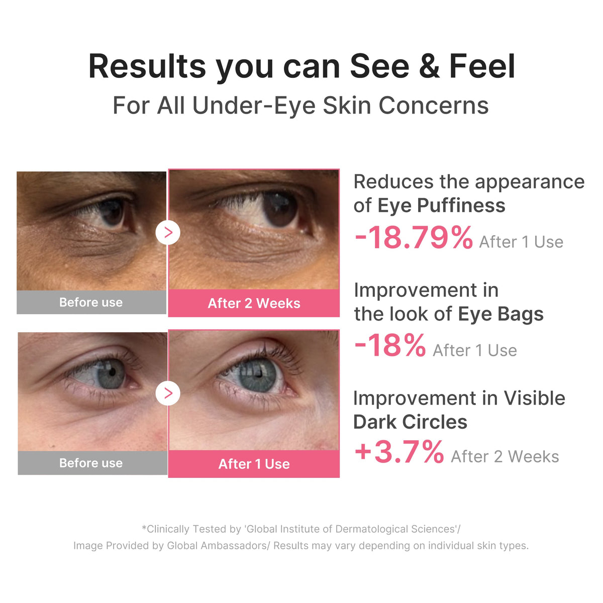 pdrn-caffeine-collagen-eye-patch-y4 PDRN_03_cdce2143-b8d8-43cb-ac69-fcbdf6640249.jpg