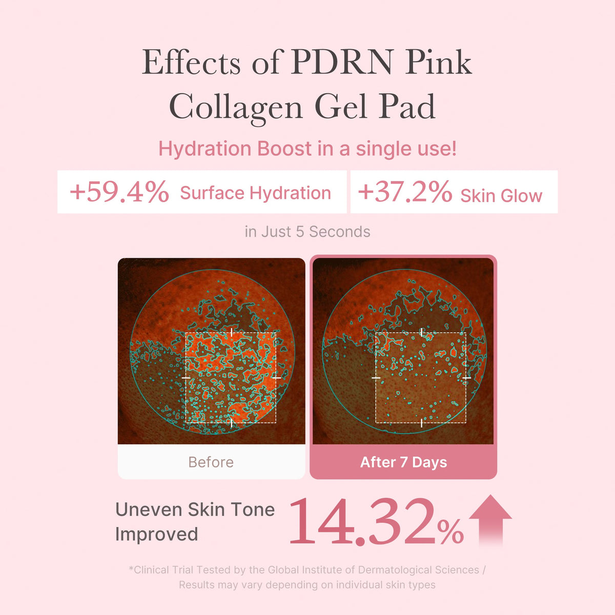 pdrn-pink-collagen-gel-toner-pad-x5 PDRN_04_f9a16a56-8d9e-4c47-a635-ed34ec3ed571.jpg