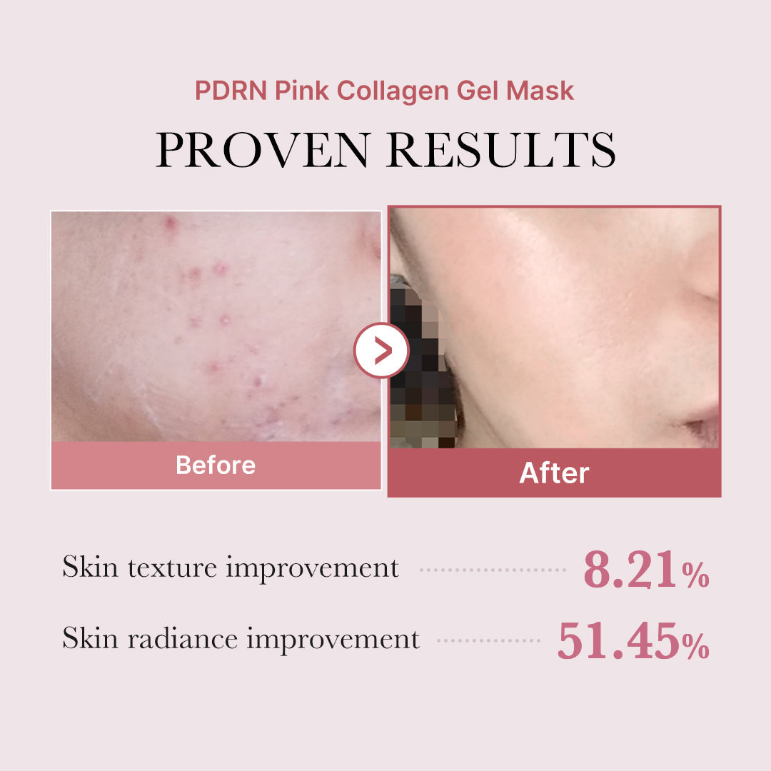 pdrn-pink-glow-full-set-m2 PDRN_12.jpg