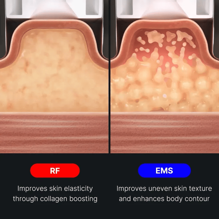 age-r-contour-body-shot-v2 img.webp